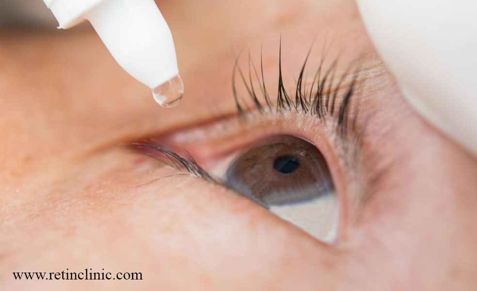 درمان بلفاریت