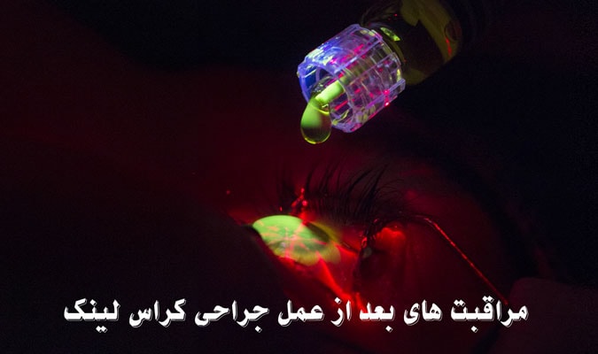 مراقبت های بعد از عمل جراحی کراس لینک 