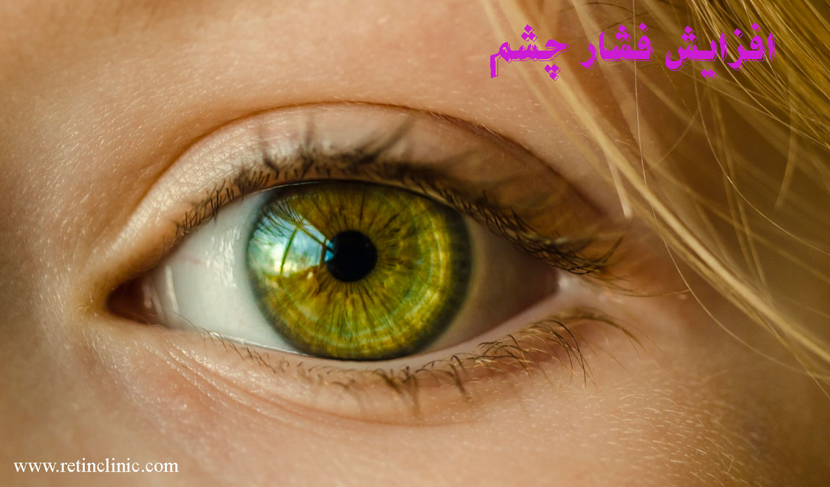 عوامل افزایش فشار چشم