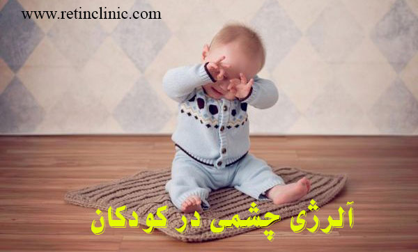 آلرژی چشمی کودکان