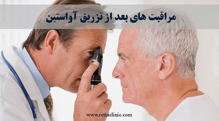 مراقبت های بعد از تزریق آواستین
