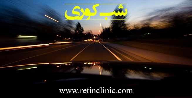 شب کوری
