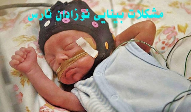 مشکلات بینایی نوزادان نارس و درمان آن ها