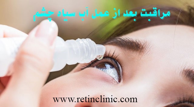 مراقبت بعد از عمل آب سیاه چشم