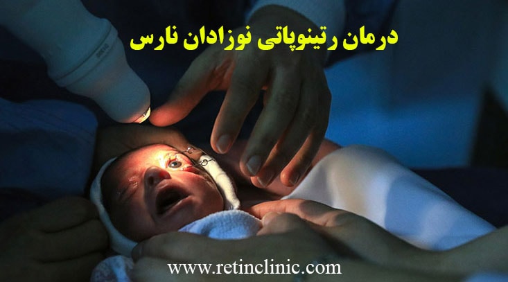 درمان رتینوپاتی نوزادان نارس
