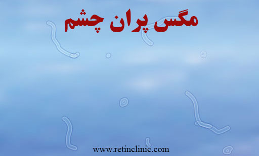مگس پران چشم 