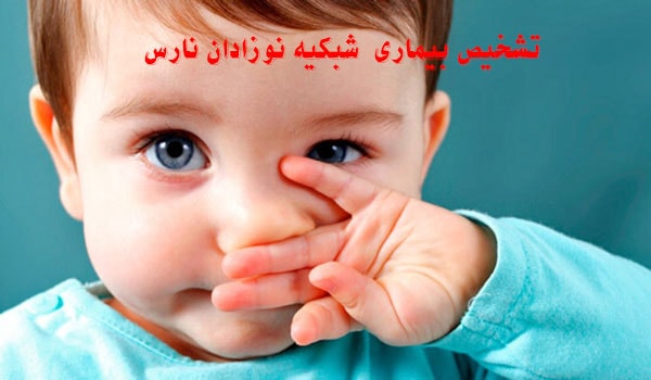 تشخیص بیماری  شبکیه نوزادان نارس