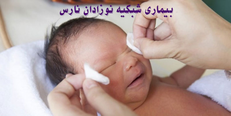 بیماری شبکیه نوزادان نارس