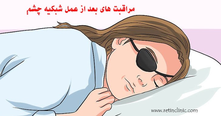 مراقبت‌های بعد از عمل جراحی شبکیه چشم