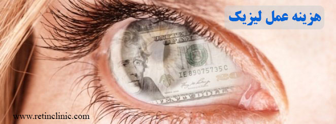 هزینه عمل لیزیک چشم